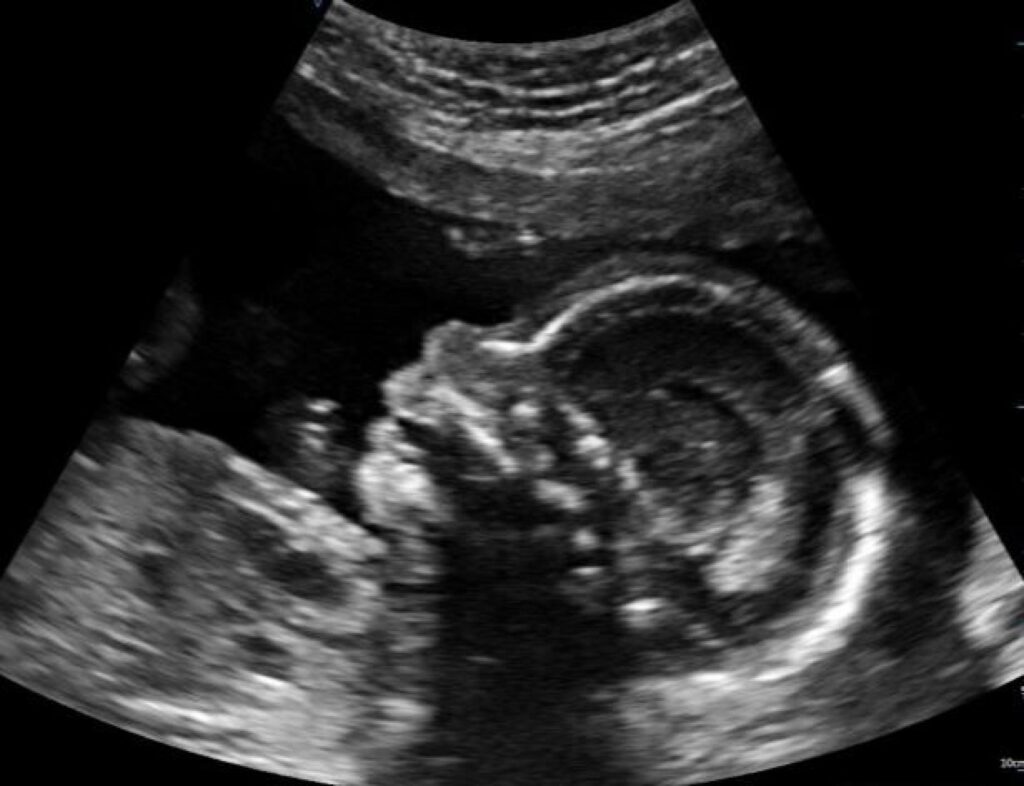 Sektion-Ultraschall-bild